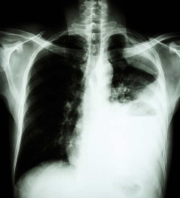 Imagen de una radiografía